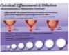 Dilation Cervical chart