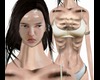 GLASS_MILK_SYNDROME