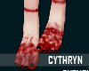 [C] Bloody Feets