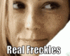 Face Freckles