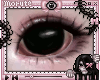 dilated