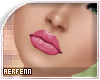 [A]Klixen Rq!