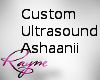 Ashaanii Ultrasound Boy