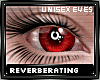 R| Red Eyes White Cornea