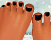 black toe$