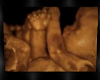 twinz ultrasound pic