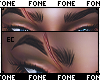Ec - F| Eyebrow Scar