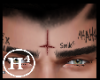 [H4] Cross Scar Forehead