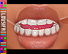 †. MH Teeth 05