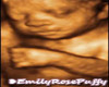 Emily Sonogram