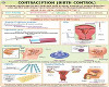 LUVI BIRTH CONTROL CHART