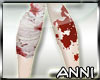 |Anni|*Bloody bandages*