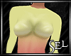 [S] Casey RL