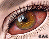 B| Bloodshot Grn Eyes