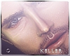 Keller - . A.B.A.D.