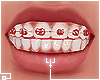  . M Teeth 160