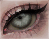 G. Anisocoria eyes
