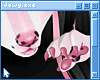 J. Speckled Nose [kit]