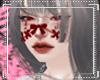 ❝W O U N D S