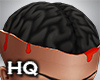Exposed Brain V2