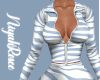 !Blue Zebra Bodysuit!