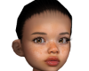 kid mh