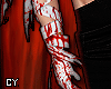 Bloodied Arm