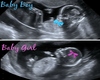 B/G Twins HH Ultrasound