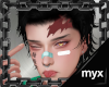 -[m]- Tanjiro's scar