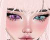 heterocromia