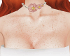 𝐼𝑧.Chest Freckles