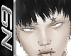 crossed eyes