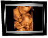 Kreams Ultrasound Pic