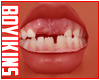 ☀. Kid Teeth 05