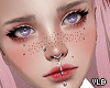 Y- Freckles