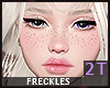 Lu-Sakura Freckles