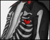 broken skeleton