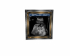 Kids Ultrasound Picture