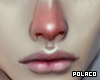 Red Nose