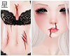 ☆. Bloody Skin : 02