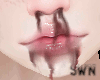 S | bloody Nose