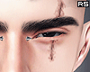 金 The Scar