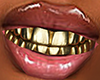F| Gold Grillz