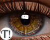 T! Heterochromia Eyes
