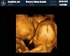 Our Babies Ultrasound