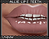 V4NY|Allie Lips Teeth6