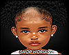 N. Seraphina Birth Mark