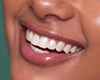 Smile Expression