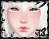 |K| Albino Sad Skin F