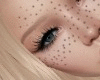 Freckles V.2
